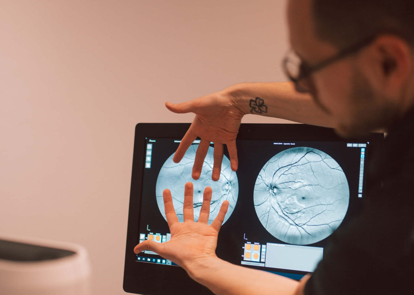 Weinseisen Optik: Kontaktlinsen und Gesundheit meiner Augen